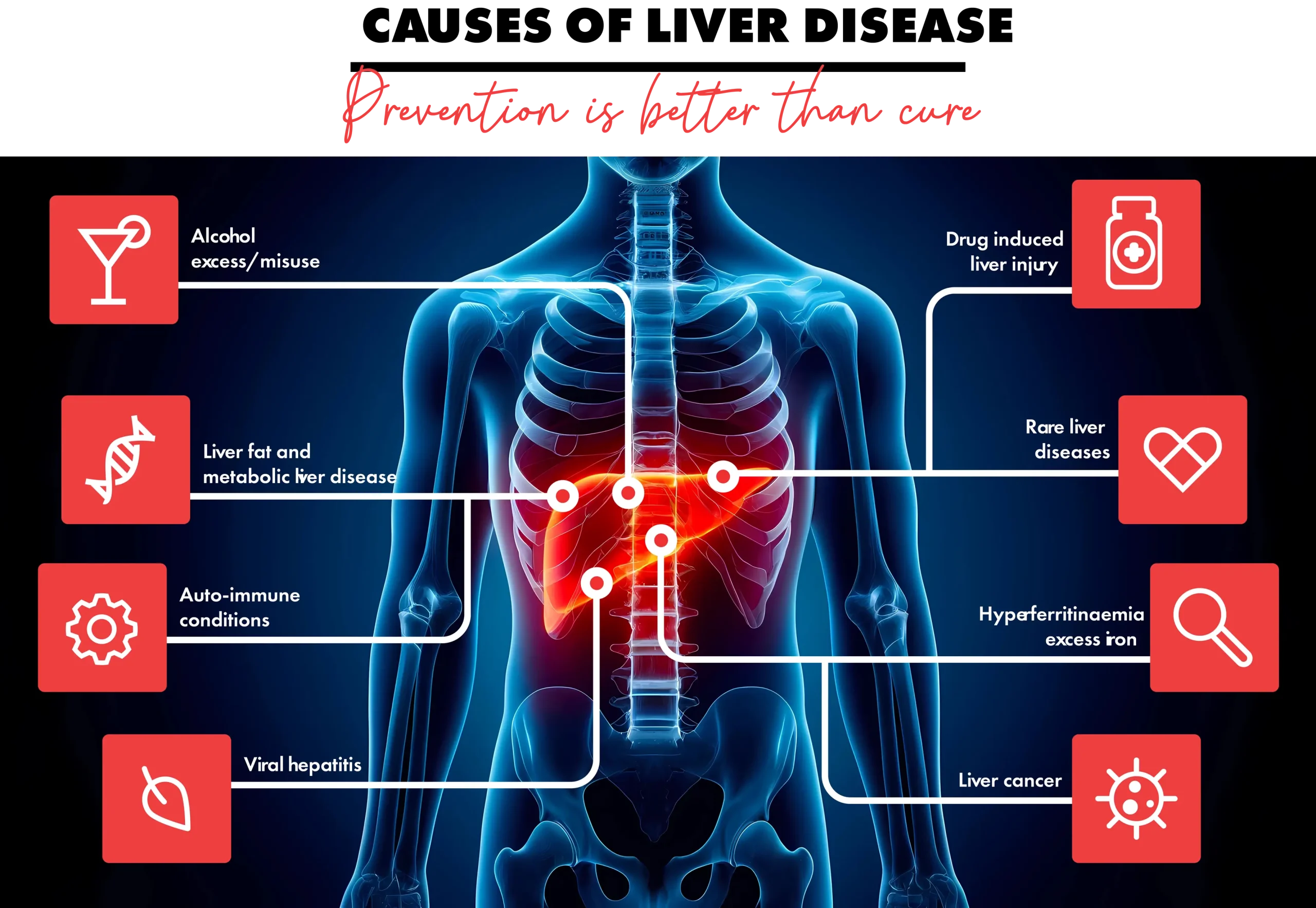 causes of liver disease